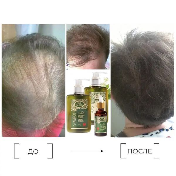 Маска для роста волос TianDe Bio Rehab восстановление и активация роста 250 г 23402 фото